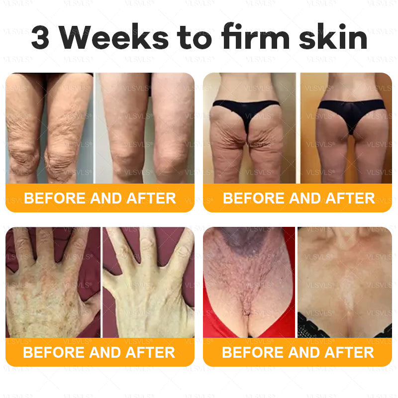 PUROSA® BEE VENOM Skin Restoration Cream – 🌸Targets Sagging Skin, Fine Lines, and Loss of Firmness on Chest, Neck & Body | Lifts & Firms Naturally 🔥 LAST DAY: 80% OFF!